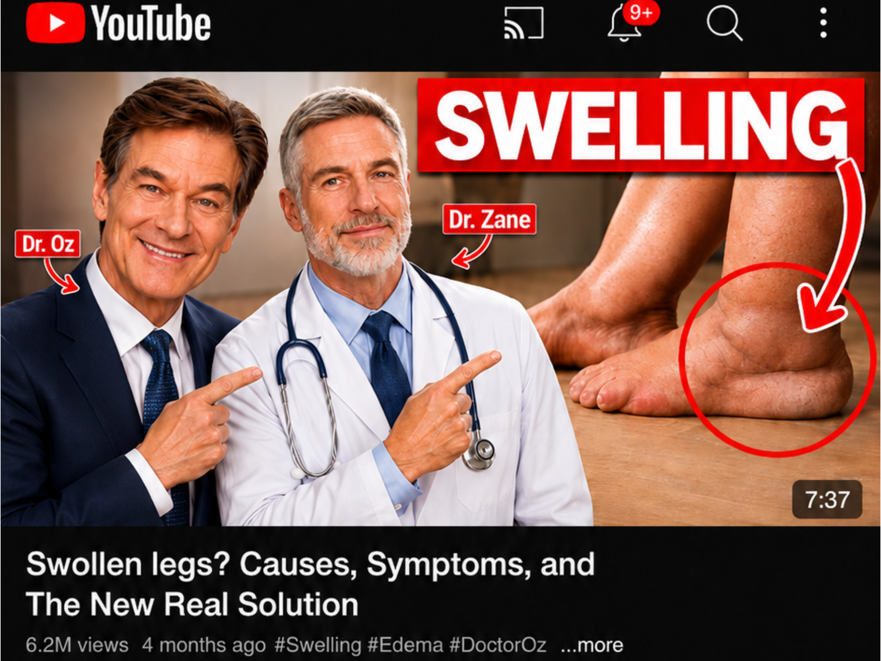Dr. Zane discussing swollen legs